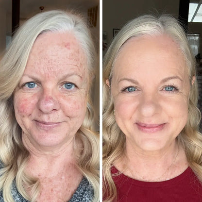 Derma Muse™ - Korean Color Changing Foundation